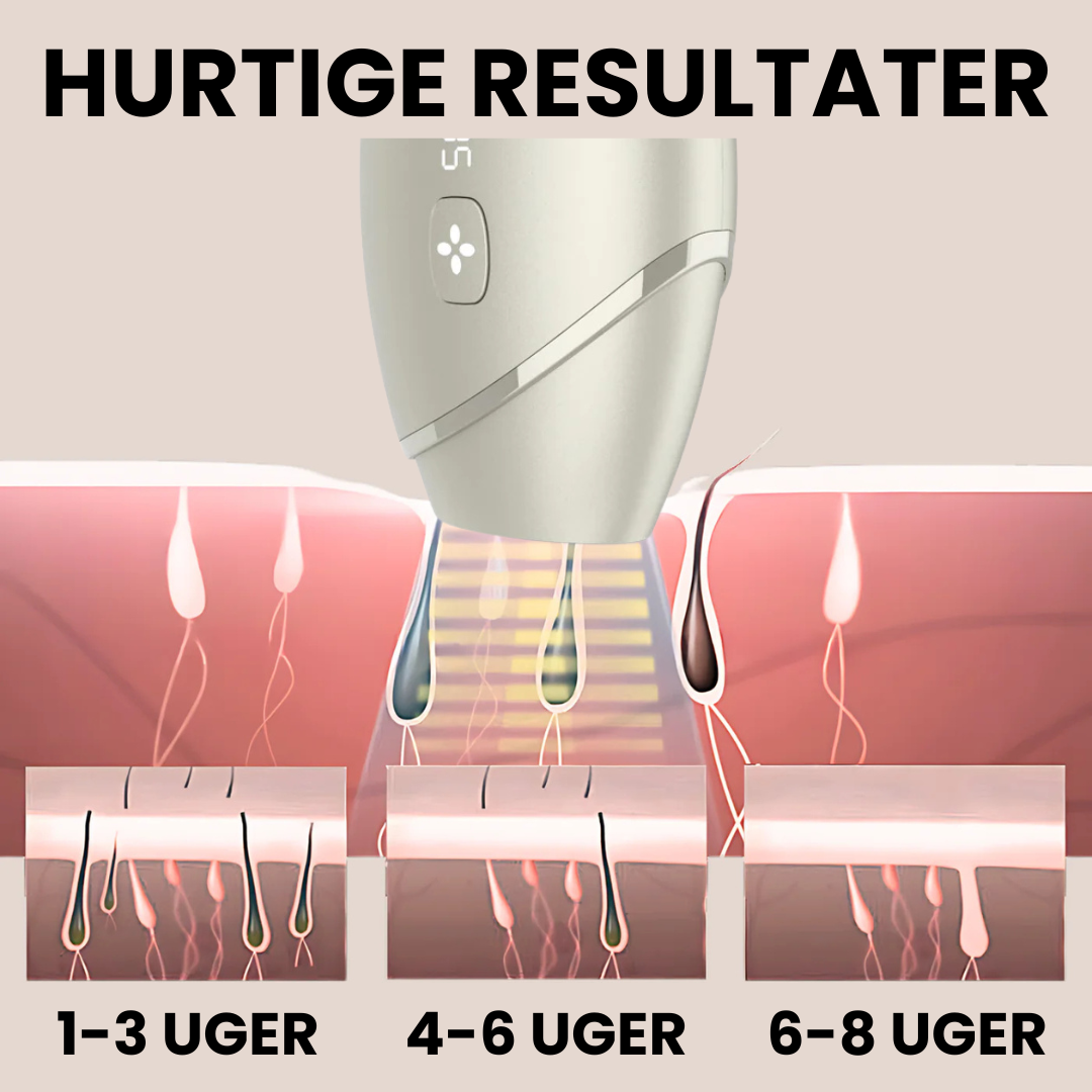 IPL Advanced+ hårfjerner - med HPLE teknologi og hele 17 J/cm² effekt