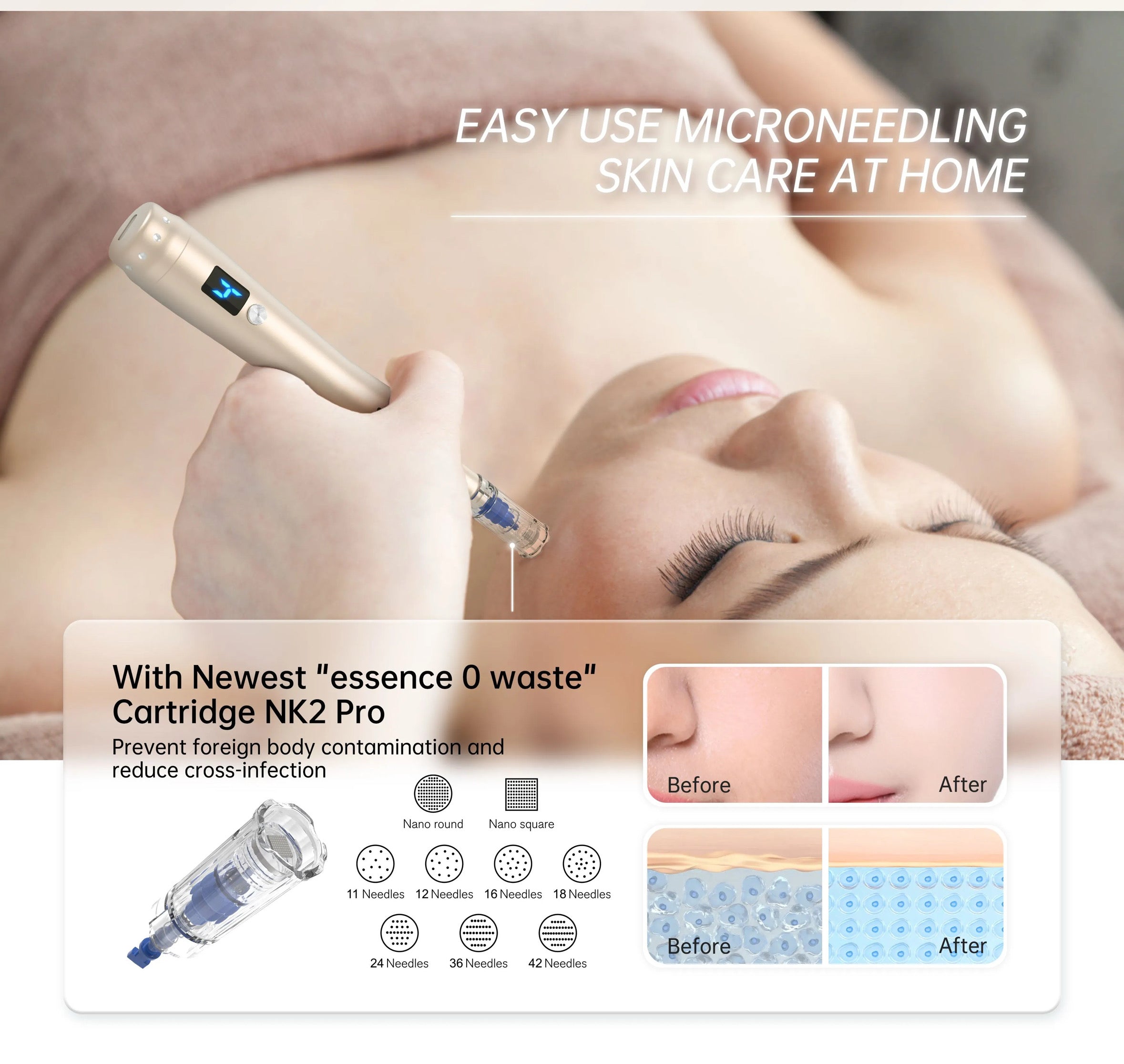 DermaPro Needles – Præcisionsnåle i flere varianter til microneedling & mesoterapi