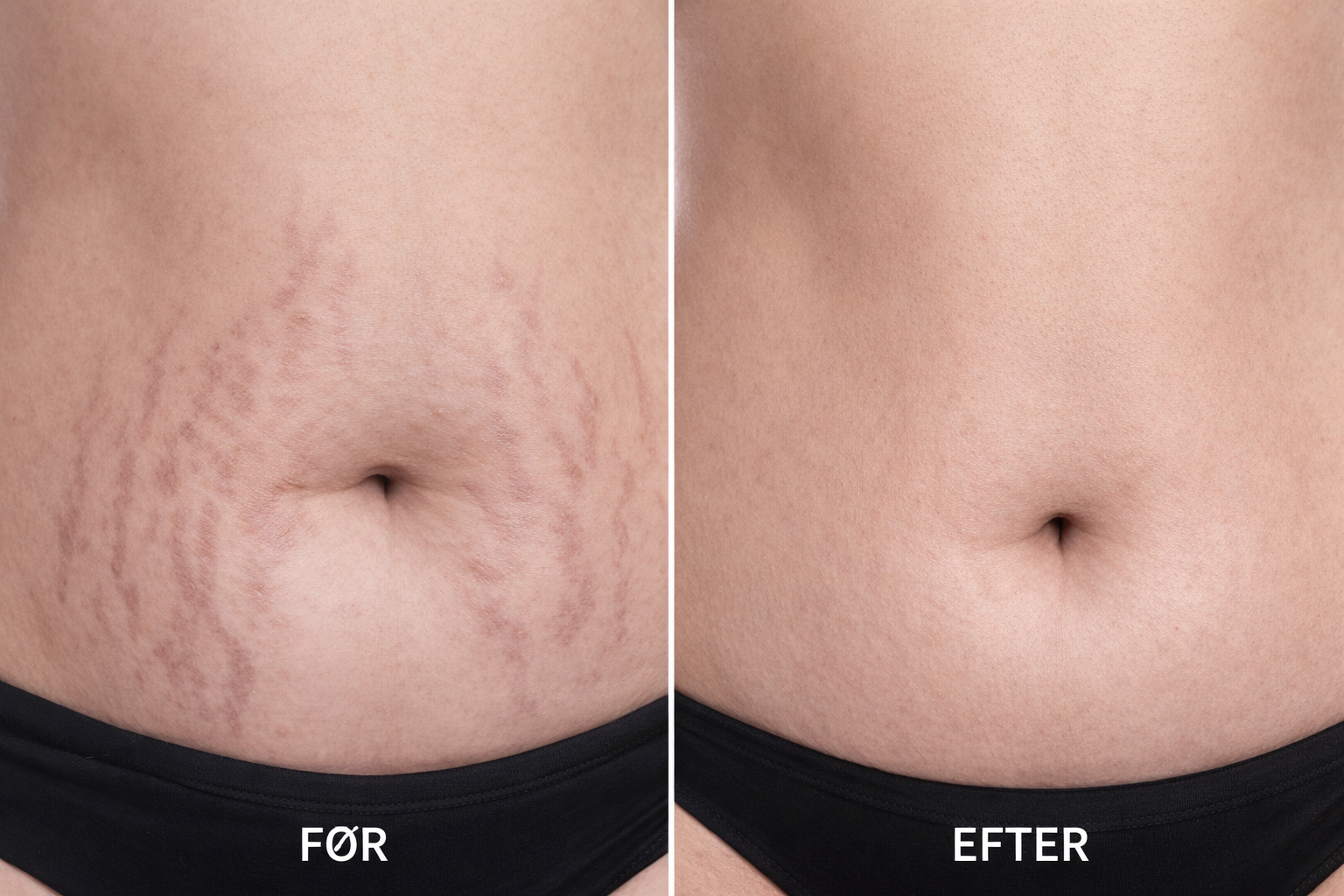 SkySkin Ultimate Skin Renewal Kit